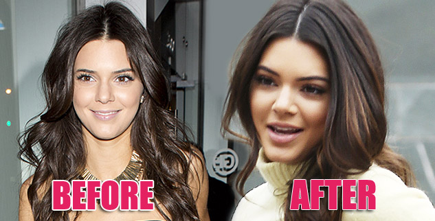 Kendall Jenner labios